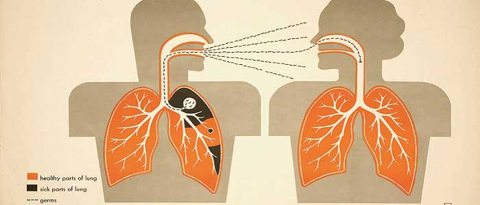 Wie wird Tuberkulose übertragen?